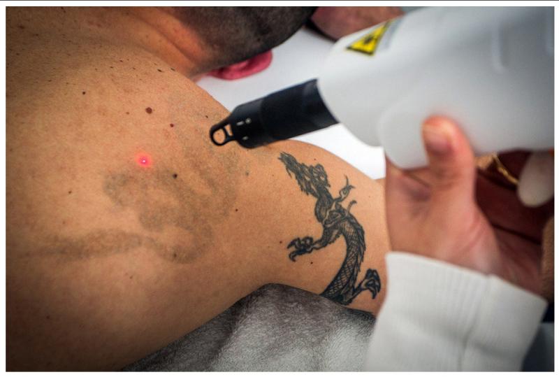 el dificil adios del tatuaje